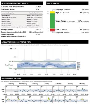 Case report: Uncovering hidden glucose patterns in medicated versus unmedicated bipolar disorder and comorbid type 1 diabetes mellitus